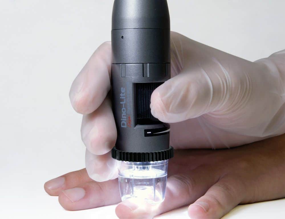 Medicinal digital håndholdt mikroskop fra Dino-Lite