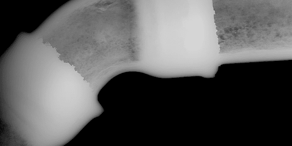 digital røntgen korrosion inspektion